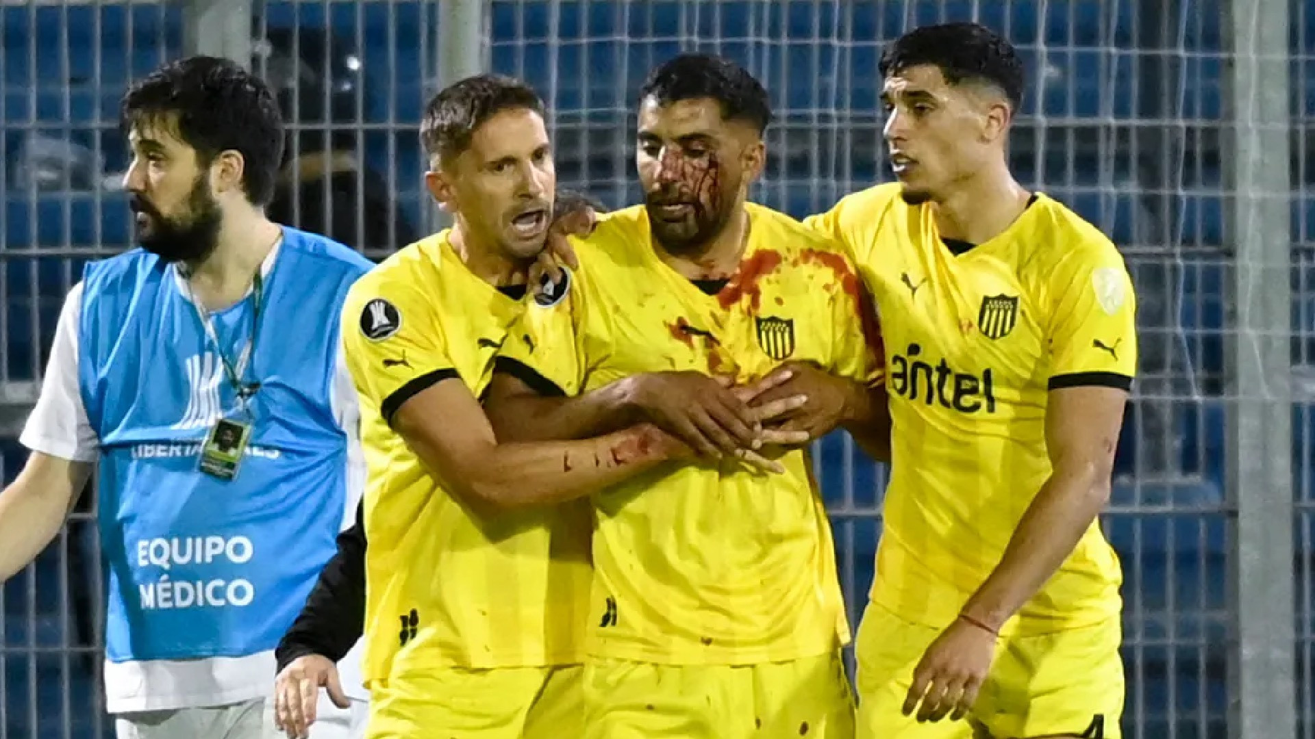 penarol-maxi-oliveira-sangue